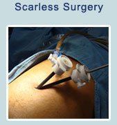 cirugia sin cicatriz visible